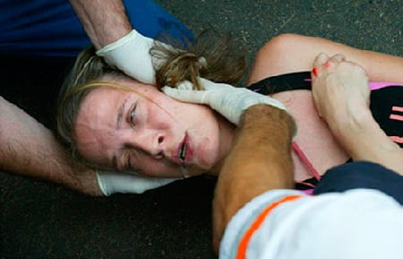 Эпилепсия помощь