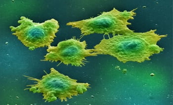 Микоплазма причины