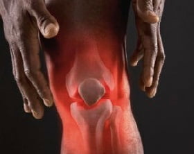 Реактивный артрит