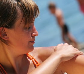 Солнечный ожог