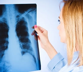 Туберкулез