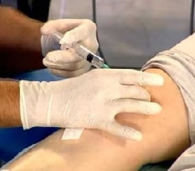 артроз коленного сустава лечение