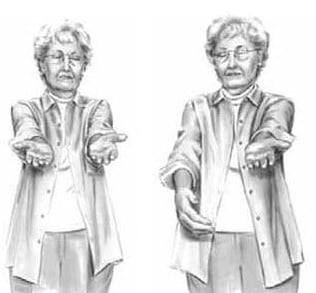 инсульт признаки и симптомы