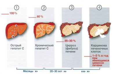 течение гепатита с