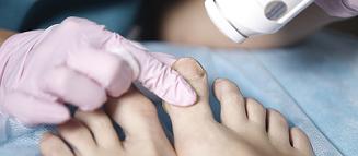 лазеротерапия