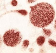 Уреаплазма у мужчин симптомы