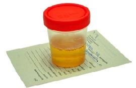 белок в моче что это значит