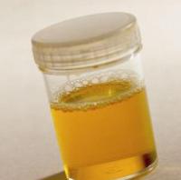 белок в моче