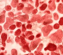 Микоплазма у женщин