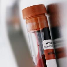 Почему повышен билирубин в крови