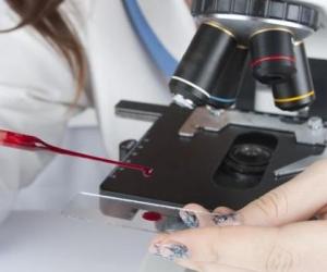 лейкоциты в крови понижены причины