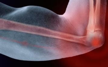 травма локтя