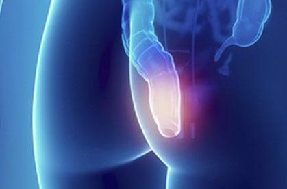 Боли в заднем проходе причины