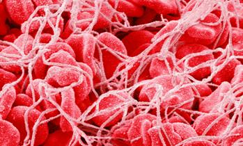 Норма тромбоцитов в крови у взрослых