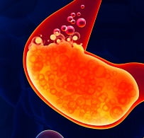 Повышенная кислотность желудка