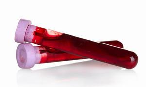 Повышенные лимфоциты причины