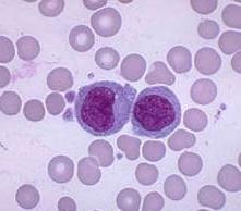 Повышенные моноциты в крови