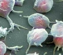 Повышенные тромбоциты в крови