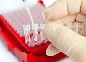 Повышенный гемоглобин