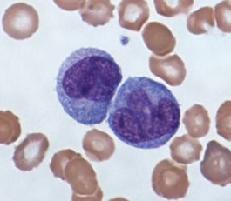 базофилы понижены