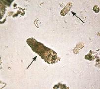 цилиндры в моче повышены