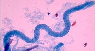 цилиндры в моче