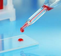 гематокрит понижен