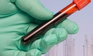 гематокрит повышен