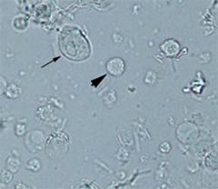 эпителий в моче