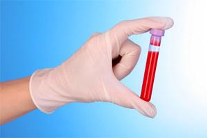 креатинин повышен у мужчин