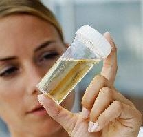 моче обнаружены нитриты