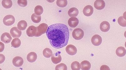 моноциты понижены причины