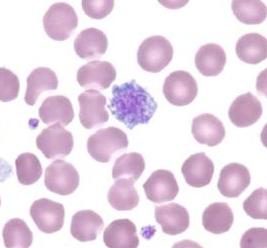 моноциты понижены