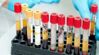 нейтрофилы повышены