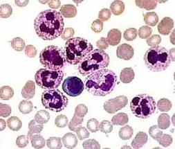 нейтрофилы в крови понижены