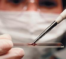 почему гематокрит повышен