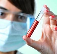 повышенное СОЭ в крови