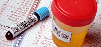 уробилиноген в моче