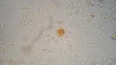 в моче билирубин повышен