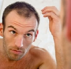 выпадение волос у мужчин