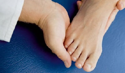 Артрит стопы лечение