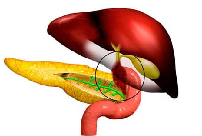Дискинезия желчевыводящих путей