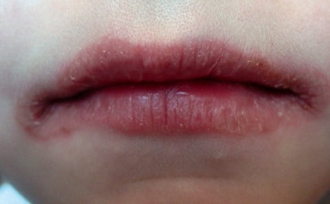 Хейлит фото