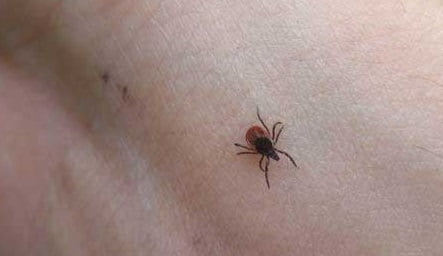 Клещевой энцефалит симптомы