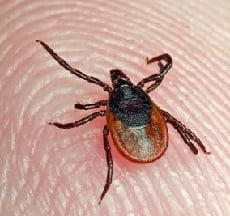 Клещевой энцефалит