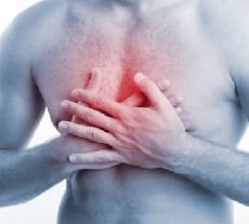 Межреберная невралгия