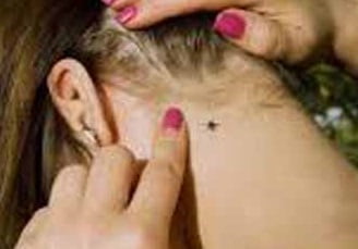 Укус клеща у человека симптомы