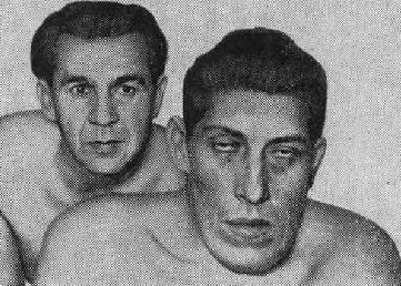 Акромегалия лечение