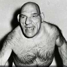 Акромегалия