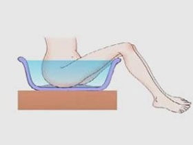 Начальная стадия геморроя лечение